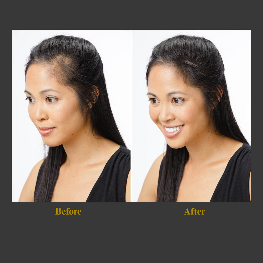 
                  
                    Hair Growth
                  
                